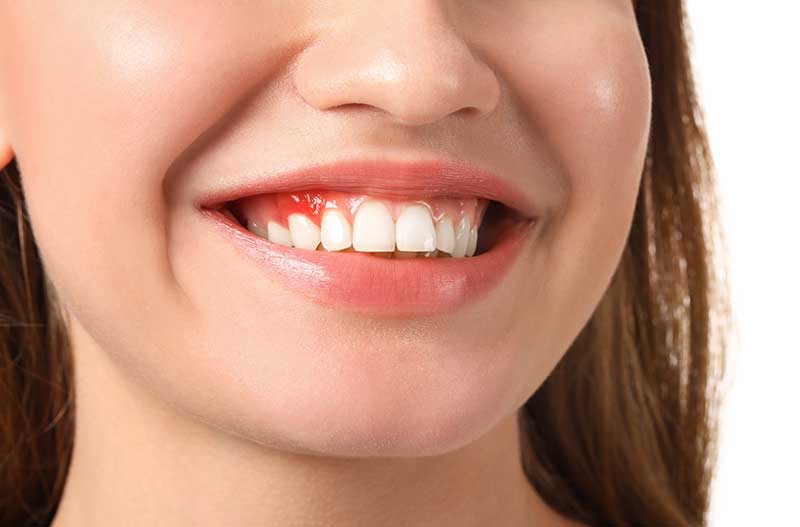debunking-dental-myths-strip2