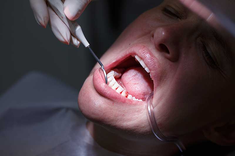 what-is-periodontal-disease-strip4