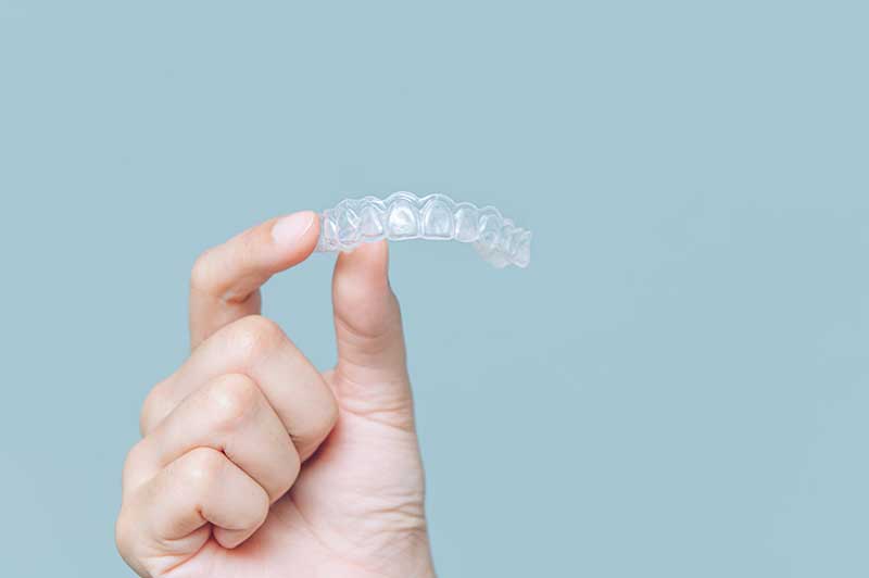 Clear Aligner Tray by Schaffer Dental Excellence
