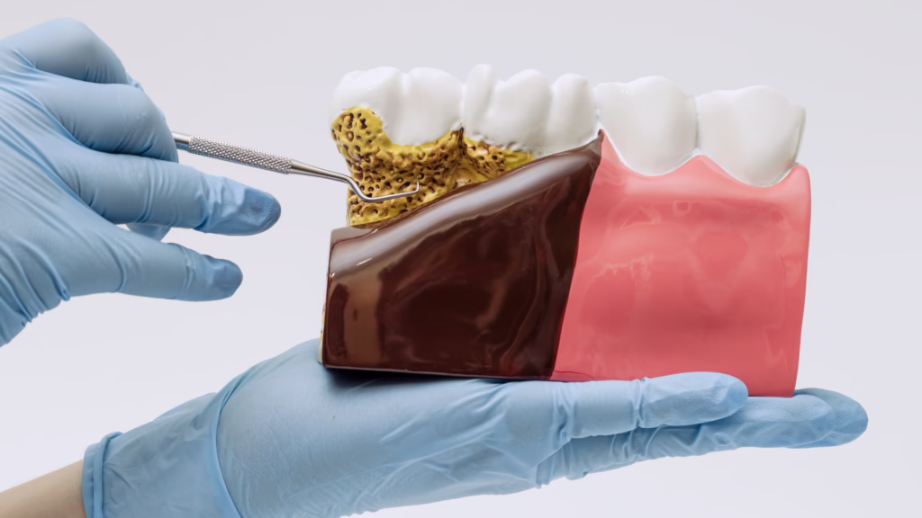 Can Gum Disease Affect Your Overall Health?