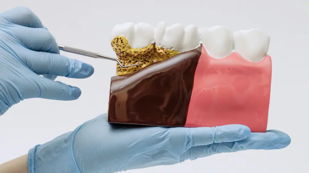 Can Gum Disease Affect Your Overall Health?